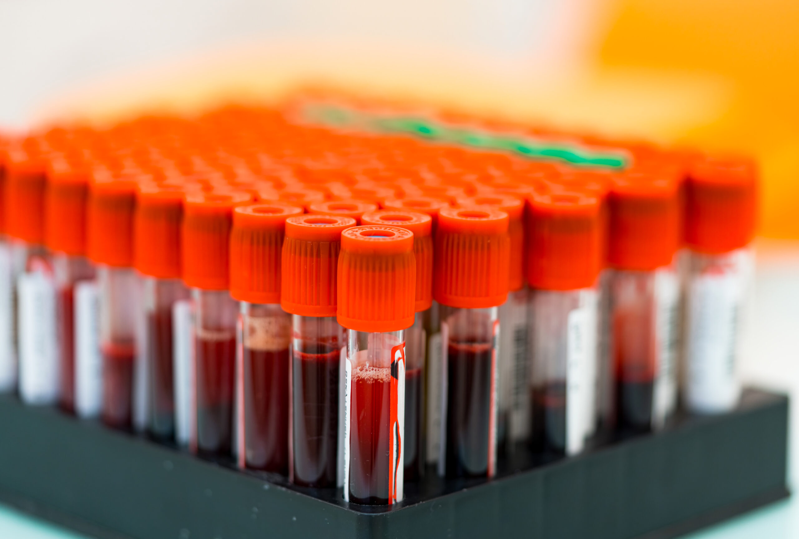 Serology