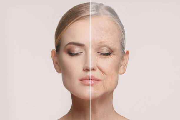 Process of skin aging